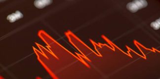 Pánico en la bolsa de Valores revela una crisis subyacente